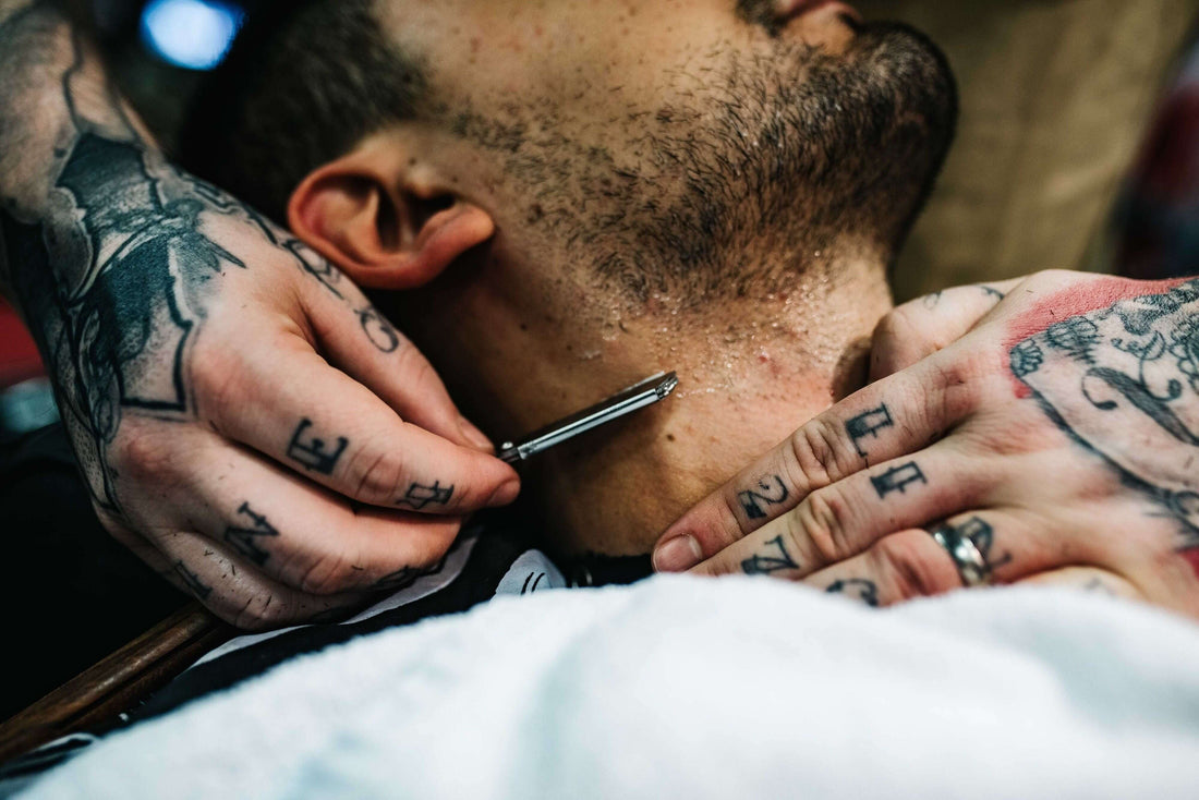 How to Treat Pimples at the Hairline I Charlemagne Blades & Tales